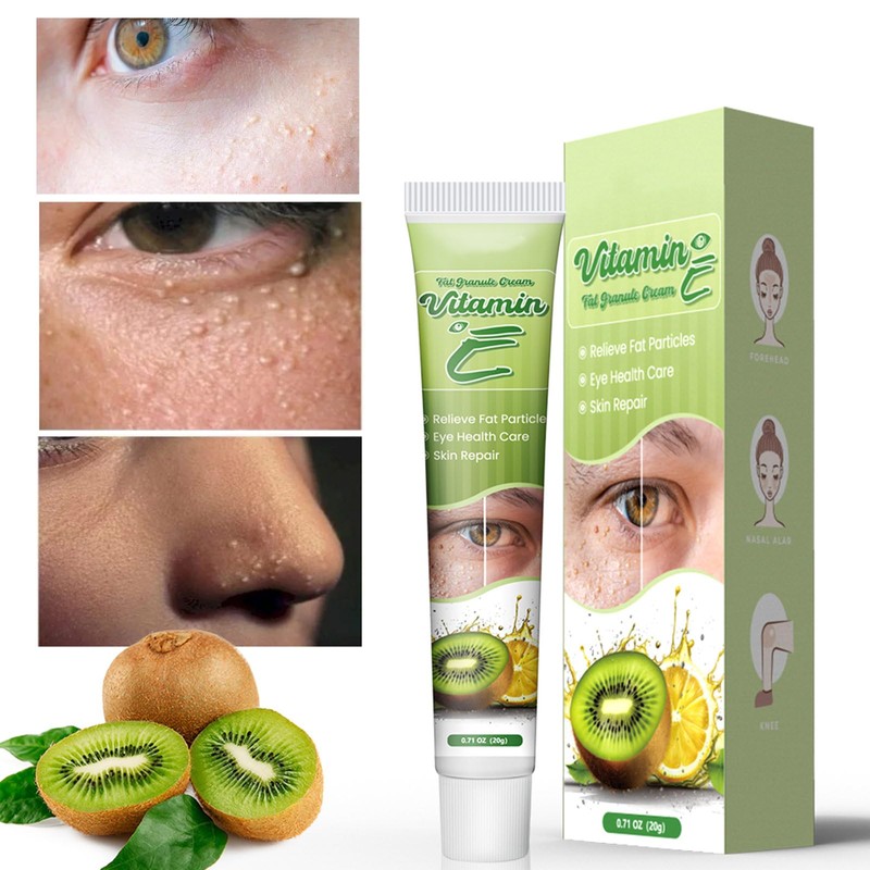 Vitamin E Milia Cream - Milia Daily Eye Care for