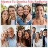 3PCS Pastas Dentales Blanqueadoras SP-14, Pasta de Dientes con Niacinamida