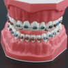 Dentalmall Typodonts Orthodontics Demonstration Model with Metal Wires and Bracket