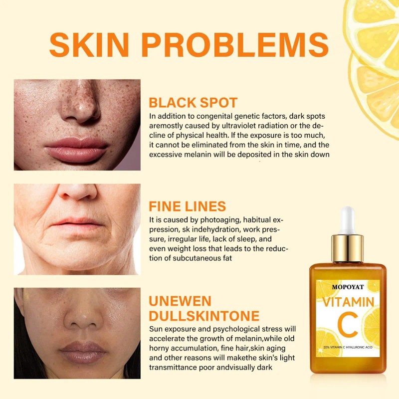 Vitamin C Boosting Serum,apto Para Todo Tipo De Pieles 2pcs