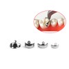 Dental Matrix Ring Set, Dental Sectional Contoured Matrix Bands Nickel
