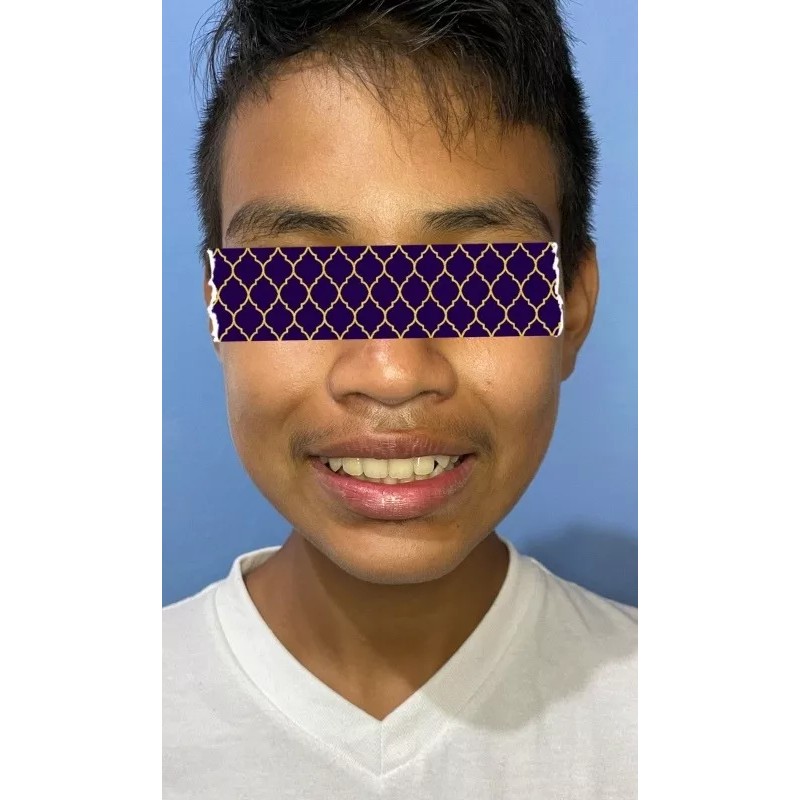 Trainer 3 Fases Dentales Bruxismo Tratamiento Completo