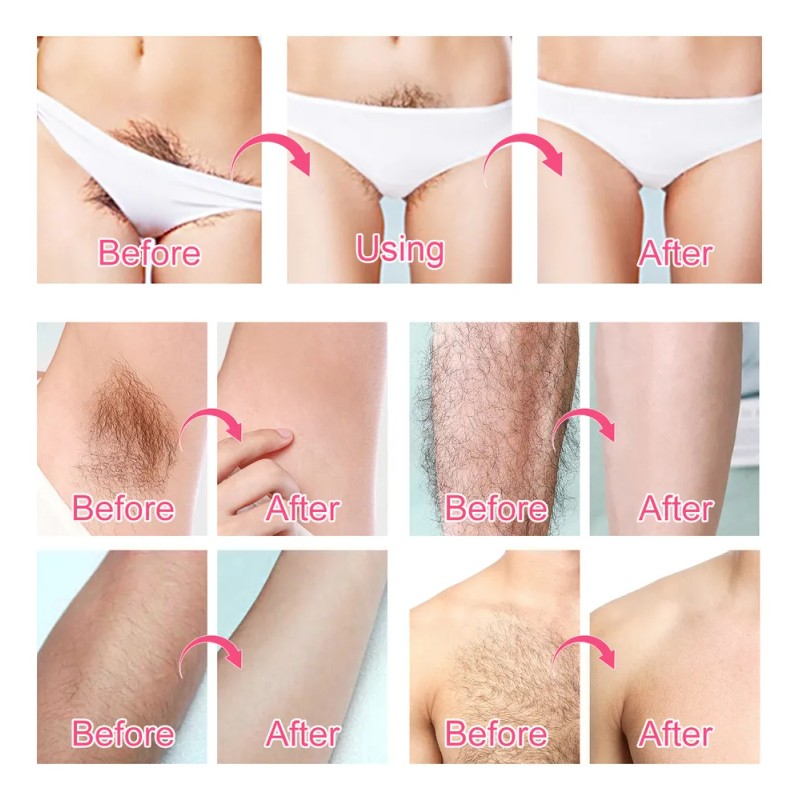 Crema Depilar Mujer Indolora Fórmula Sensible Areas Intimas
