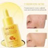 Serum De Cúrcuma Bioaqua Ácido Hialurónico Antioxidante