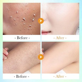 Orange Peeling Essence - Revitalizing Facial Exfoliator for Deep Cleansing, Gentle Exfoliation, and Radiant Skin Essence, Ideal for Both Face and Body