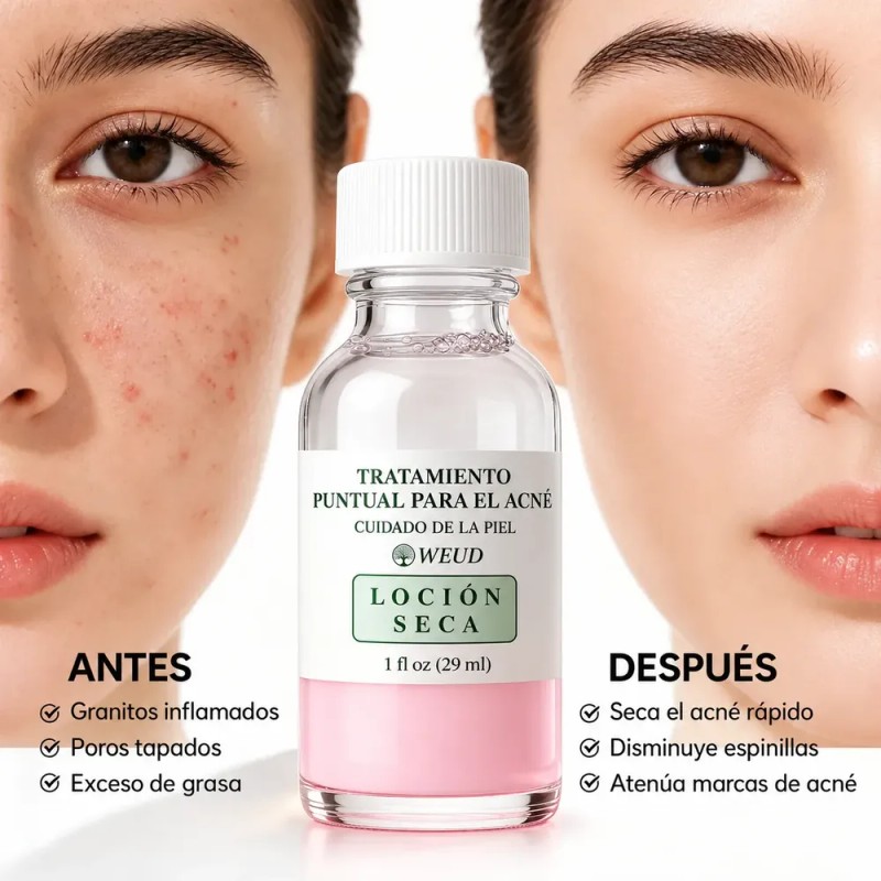 Sérum Bifásico Antiacné Puntos Rojos Y Espinillas Noche Weud