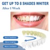 Teeth Whitening Essence Pen for Cleaning Teeth Stains, Freshening Breath