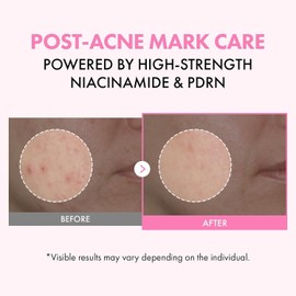 Tosowoong Pink PDRN Niacinamide Milk Toner 5% Dark Spot Care Salmon DNA Soothing Ceramide 3 Types & Peptide 12 Types Moisturizing Glass Glow Skin Korean Skin Care 150ml / 토소웅 핑크 PDRN 나이아신아마이드 밀크 토너 5% 다크 스팟 케어 연어 DNA 진정 세라마이드 3종 & 펩타이드 12종 보습 글래스 글로우 스킨 코리안 스킨케어 150ml