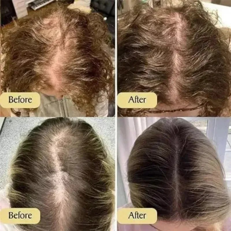 2026r.f Jjlsss)2pcs Aceite Esencial Para Cuidado Del Cabello