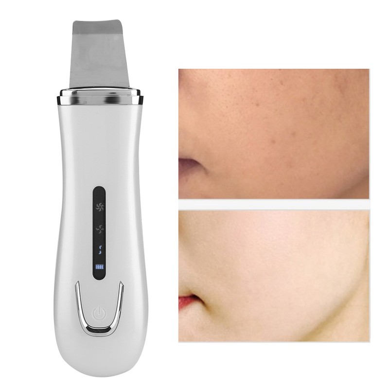 Ultrasonic Face Skin Scrubber Blackhead Removal Ion Cleaner Facial Cleanser