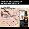 Thick Toenail Fungus Repair Essence 50ml 3ea