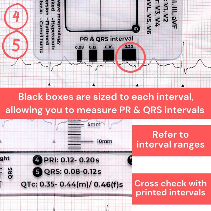 ECG 7 Step Ruler, ECG/EKG 7 Step Ruler Card for