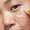KORA Organics Noni Radiant Eye Oil 10ml