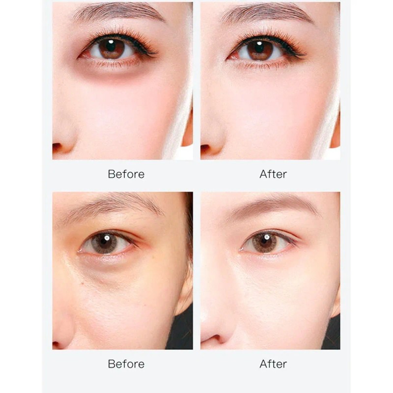 20 Tarro Parche Hidrogel Ojos Colageno Anti Ojera Hidratante