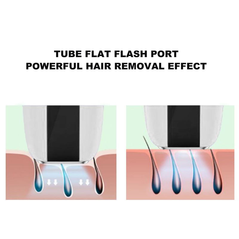Hair Remover Safe Painless 5 Levels 2 Flash Modes Hair