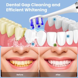 Duolosy Electric Toothbrush with Water Flosser, 2 in 1 Cordless Toothbrush and Water Flosser Combo,Water Flosser for Travel and Home (White)