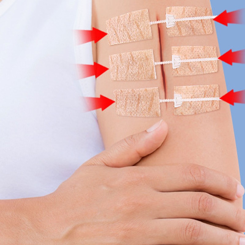3 Pcs Wound Closure Strip Stitchless Self Adhesive Non Woven