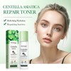 Kit Facial Centella Asitica para Rostro, Limpieza Profunda, Hidratacin Intensa,