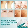 Crema Removedora Eficaz Mezquinos Verrugas Lunares Sin Dolor