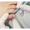 Skin curette, sharp Kai curette for curettage, Kosmetex skin curettes,