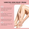 Crema Ximonth Para Várices Y Piernas Cansadas Neutra