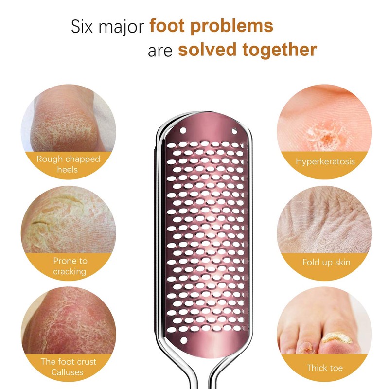 Pedicure Foot File Callus Remover - Large Foot Rasp Colossal