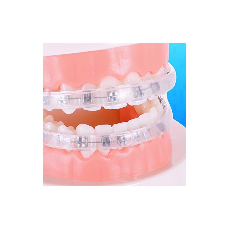 Comfort Covers for Braces - Protector bucal ortodóntico, protector de