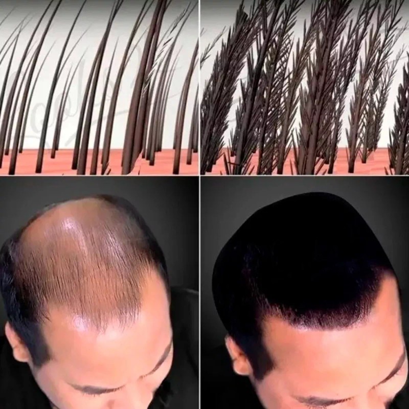 Universo en Linea Paquete Caboki Fibras Naturales Sustituto 2 Pzas