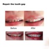 Tooth Filling Thermal Beads Do it Yourself Moldable False Teeth