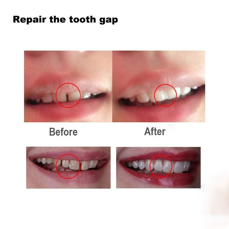Tooth Filling Thermal Beads Do it Yourself Moldable False Teeth