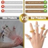 Occewoker Acupressure Ring, 18 Pcs Massage Finger Rings, Sensory Rings