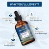 Parachute Advansed Parachute Advansed Ayurvedic Coconut hair oil & Rosemary