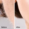 Skinharbor Sonic Dermaplane Blade Refills - 10 Dermaplaning Blades- 2
