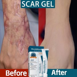 West&Month High-Grade Formula Scar Gel, ScarRepair Surgery Scar Pregnancy Smoothing SkinCare Gel - Specification: 1pcs( 20% of people choose)