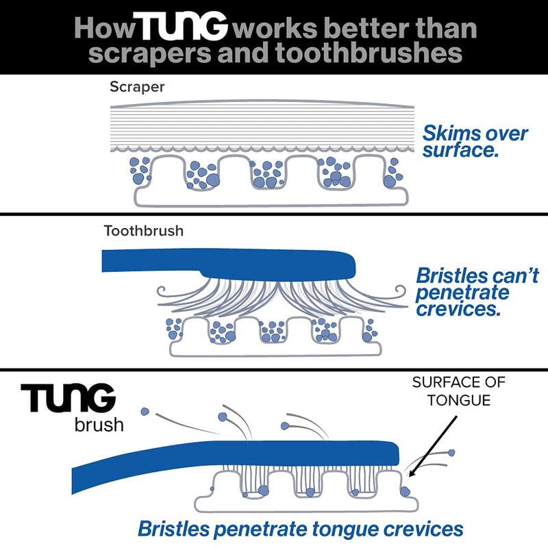 TUNG Brush Tongue Cleaner, Plastic TUNG Scraper, Tongue Cleaning to