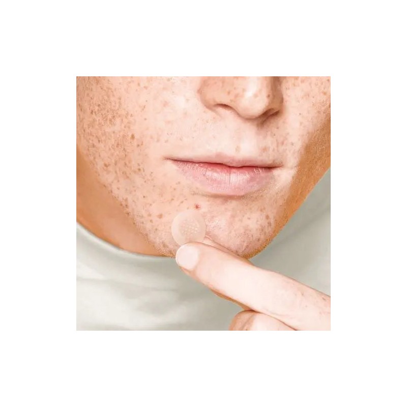 Acnemy Zitless Microdart Pimple Patches