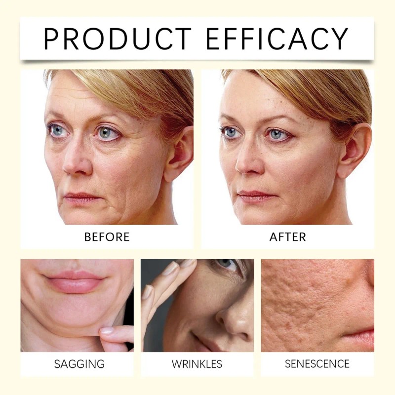 Crema Hidratante For El Cuidado De La Piel