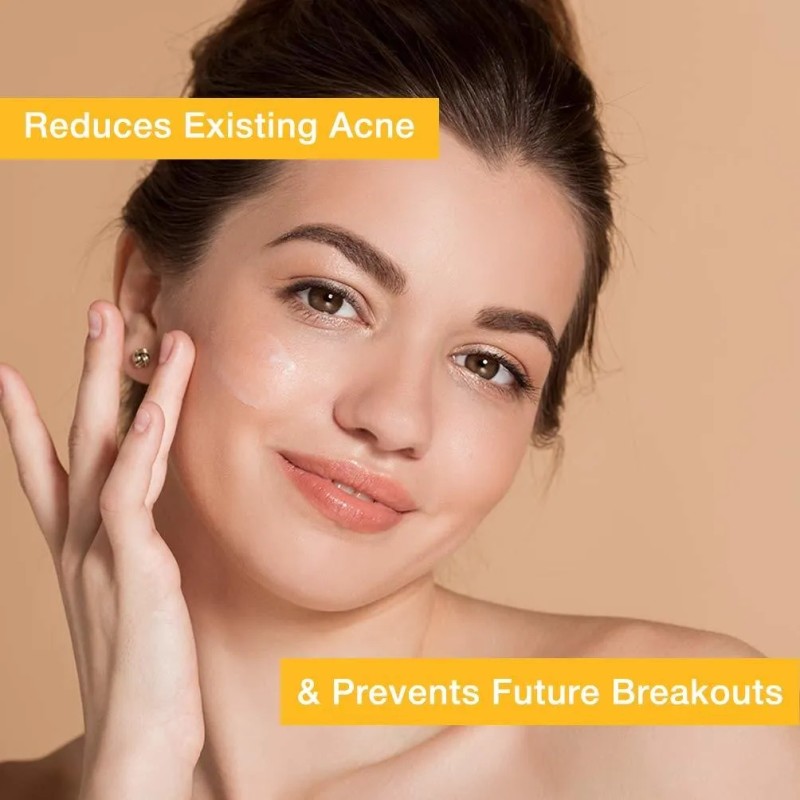 Toque Peróxido De Benzoilo 2,5% Acne Treatment Gel Crema -