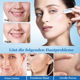 Soleneva 1.5ml*15PCS Hyaluron Serum Ampullen, Intensiv Feuchtigkeitsspendendes Hyaluronic Acid Serum Gesicht mit Hyaluronsäure, Anti Aging Hautpflege für Haut, Tiefenpflege Nährt und strafft die Haut