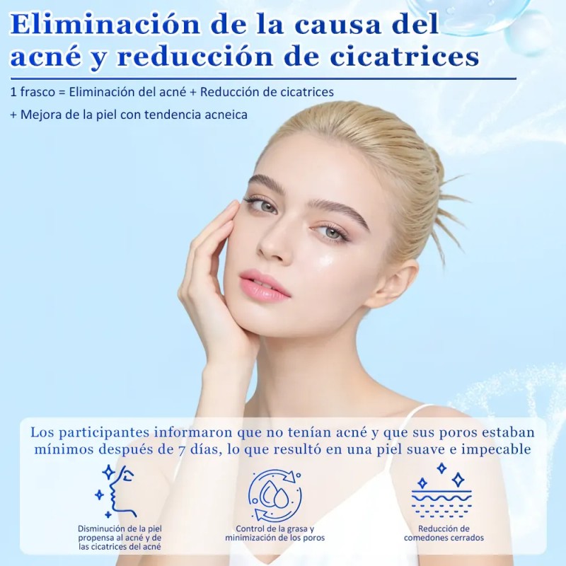 Acne Buster Loción Secante Con Ácido Salicílico 10ml