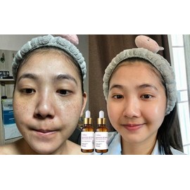 Retinol Venature Bakuchiol Retinol Rejuvenation Serum- 30ml