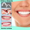 Dientes Postizos Temporal Falsos Carillas Dentales