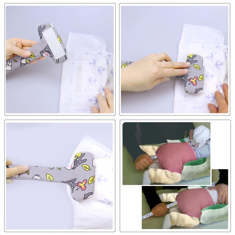 Hip Dysplasia Changing Diapers with Velcro for Spica Body Cast