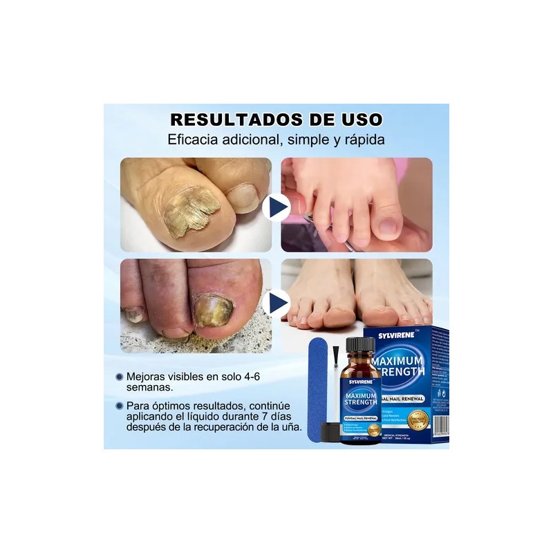 Para Eliminar Hongos En Uñas De Manos Y/o Piessolución