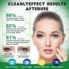 Suplemento Nutricional Gwynne Luteína Zinc Vitaminas Salud Macular Ojo Seco