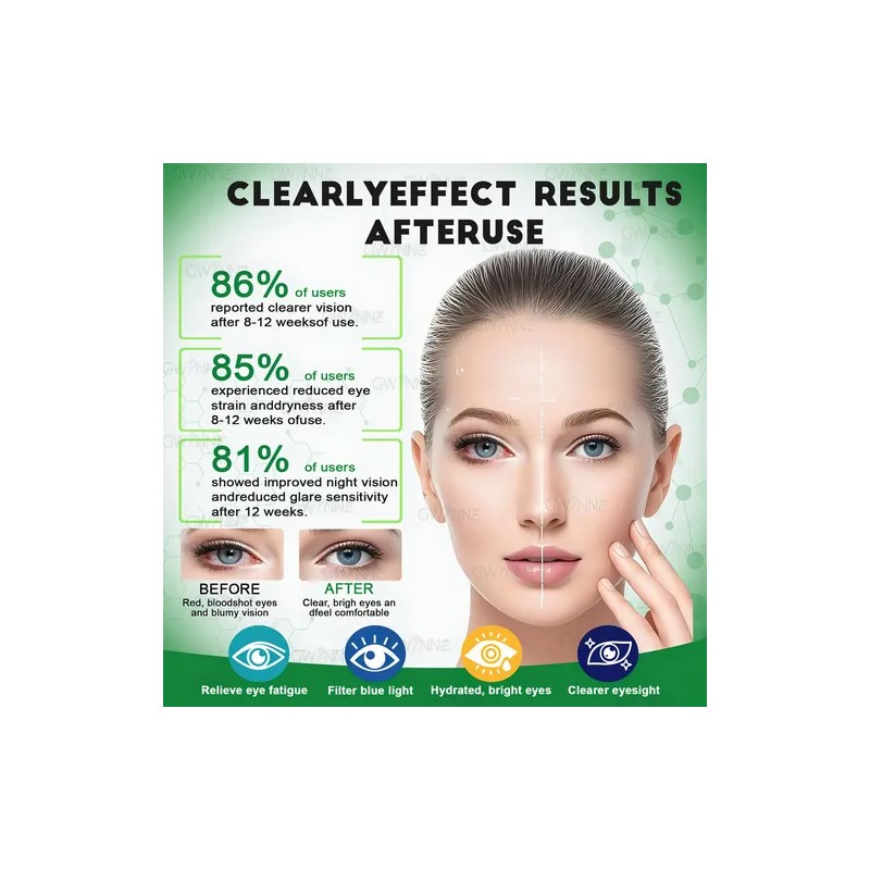 Suplemento Nutricional Gwynne Luteína Zinc Vitaminas Salud Macular Ojo Seco
