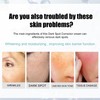 Tkekruh Dark Spot Remover for Face