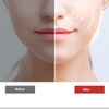 Facial Slimming Machine Red Blue Light 5 Gears High Frequency