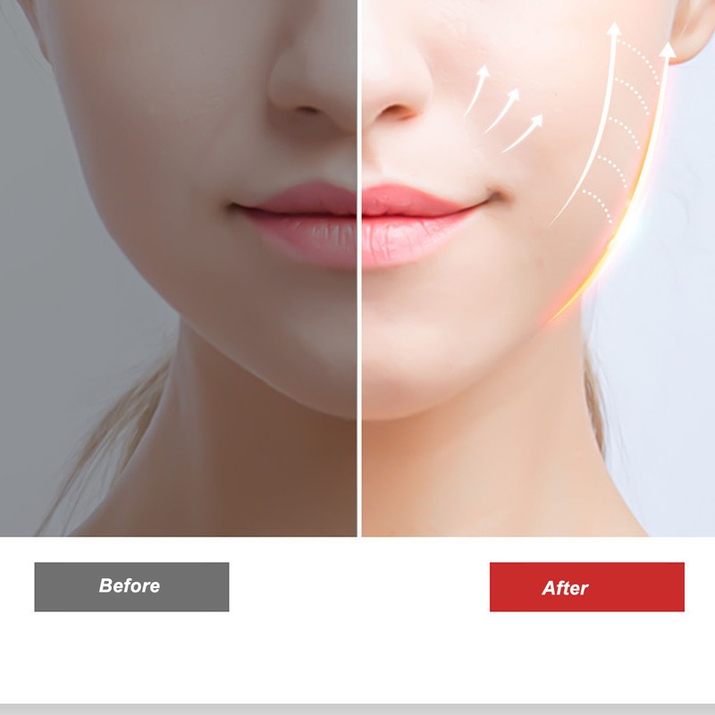 Facial Slimming Machine Red Blue Light 5 Gears High Frequency