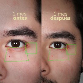 Roll On Contorno De Ojos Blackbeard Antiedad Y Antiojeras Todo Tipo De Piel Día/noche